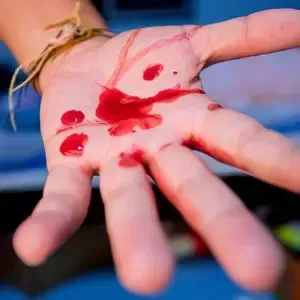 Inspeção visual: Prática do curso de Stop The Bleed (Controle de Hemorragias) - Registro 5